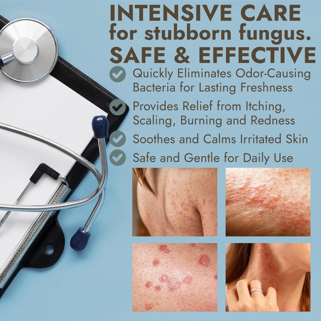tinea-versicolor-treatment-antifungal-sp-4.jpg