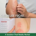 manuka-honey-eczema-cream-moisturizing-l-2.jpg