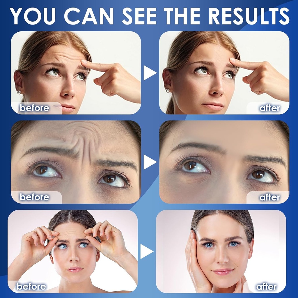 forehead-wrinkle-patches-12pcs---facial--6.jpg