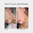 jshealth-vitamins-skin-and-digestion-for-5.jpg
