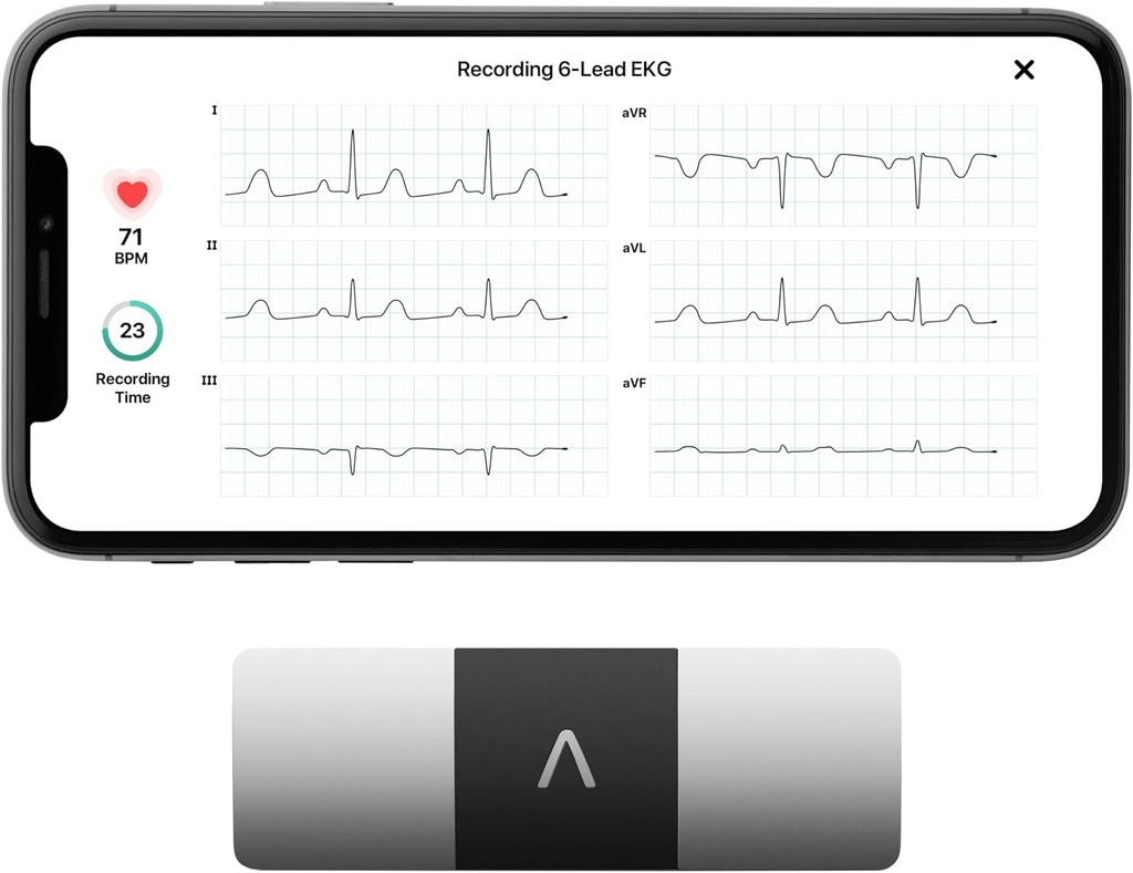 AliveCor KardiaMobile 6-Lead Personal EKG Monitor – Six Views of The Heart – Detects AFib and Irregular Arrhythmias – Instant Results in 30 Seconds – Works with Most Smartphones